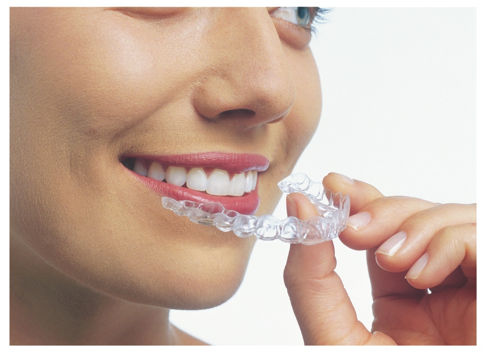 Invisalign-Photo-Adult-Holding-Aligner