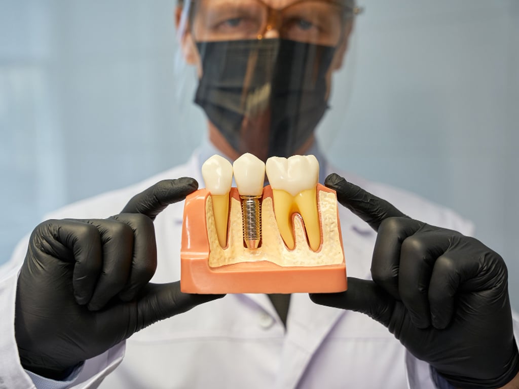 A Permanent Solution: How Dental Implants in Barrie Can Restore Your Smile for Life