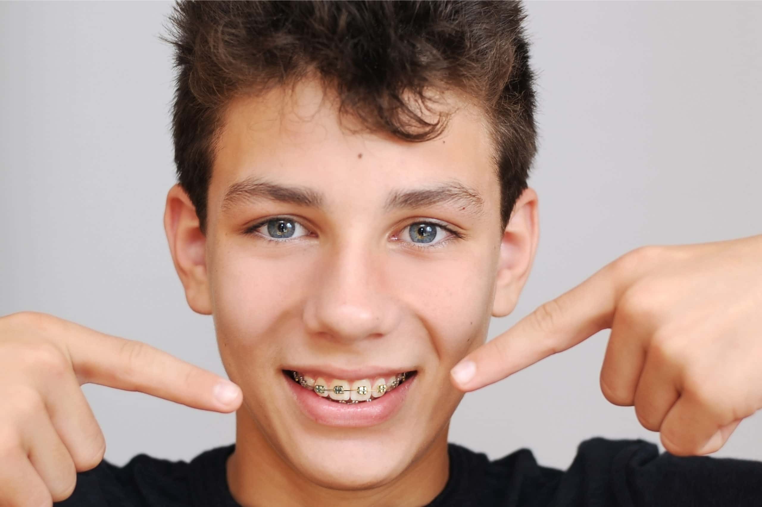 Young boy with smile pointing his teeth having braces with both hands