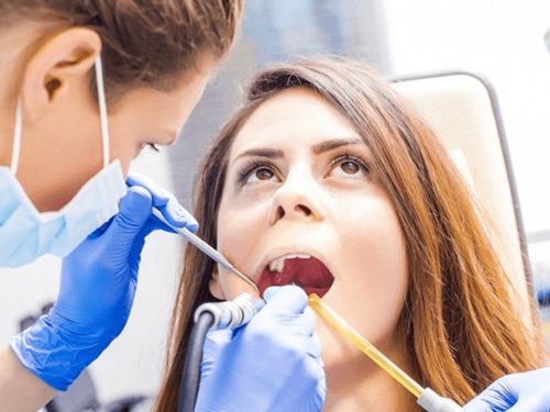 Chipped-Tooth-Banner Chipped-Tooth-Banner
